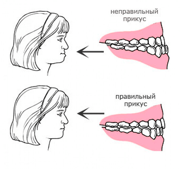 Нейромышечная стоматология